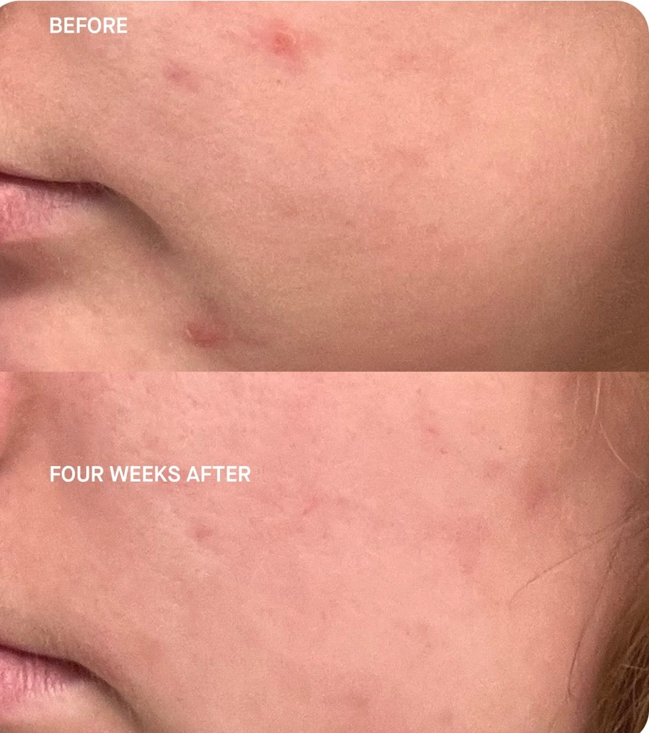 Brandefy Clinical Vit C + Silym Clarify Serum