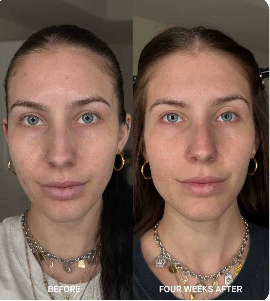 Brandefy No Needles Renew Serum