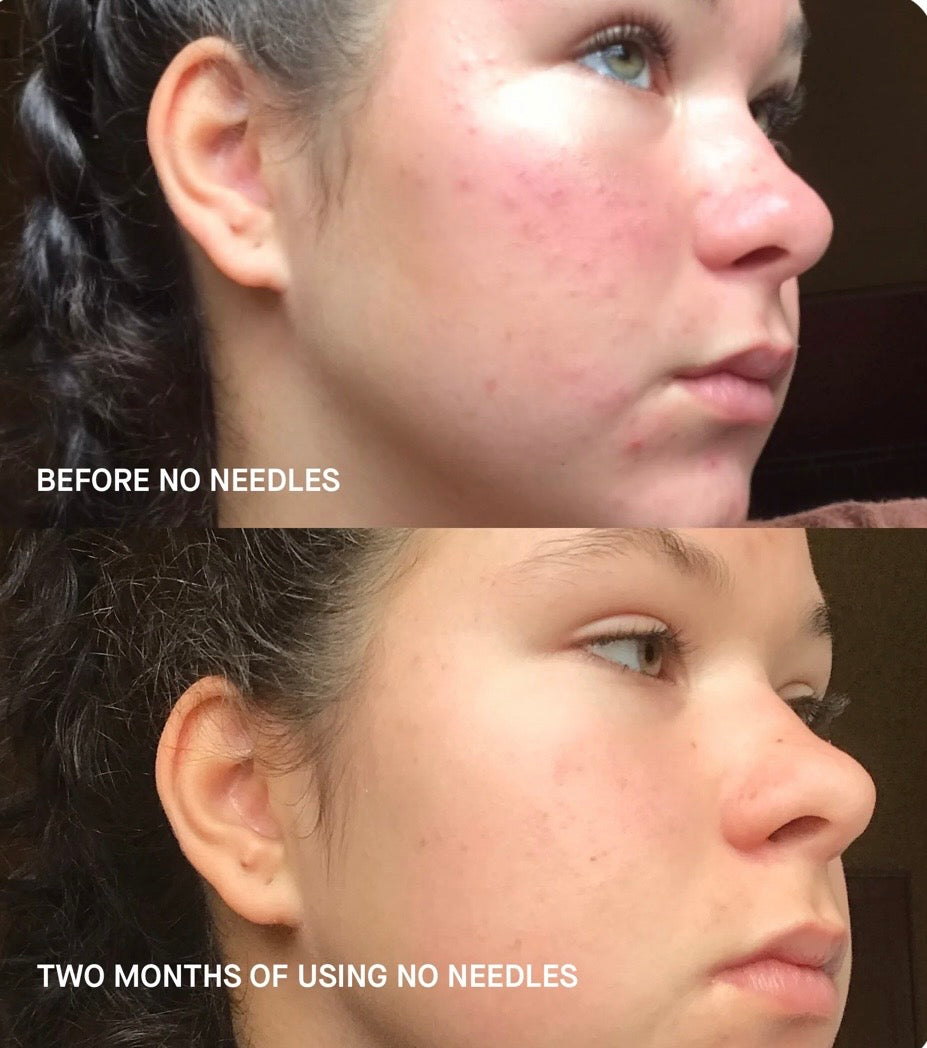 Brandefy No Needles Renew Serum