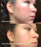 Brandefy No Needles Renew Serum