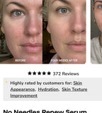 Brandefy No Needles Renew Serum