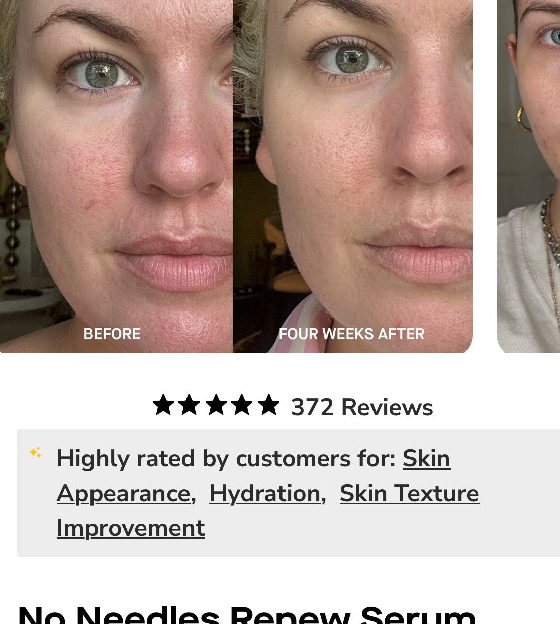 Brandefy No Needles Renew Serum