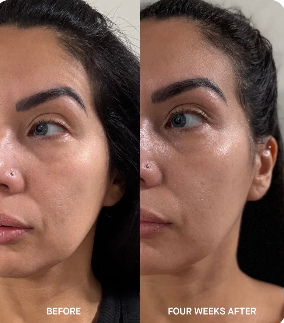 Brandefy Tri Lipid Replenish Treatment